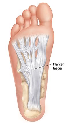 Plantar Fasciitis Sarah Bush Lincoln