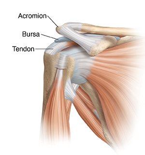 shoulder impingement diagnosis