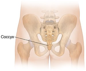 Coccydynia (Tailbone Pain)